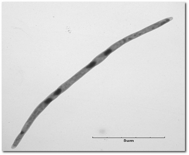 The culprit? [Courtesy of Dr. Allen-Vercoe, University of Guelph Katz Lab](https://www.flickr.com/photos/92803392@N02/9460876768)